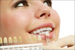 Laser Teeth Whitening Melbourne CBD | Teeth Whitening Cost Melbourne